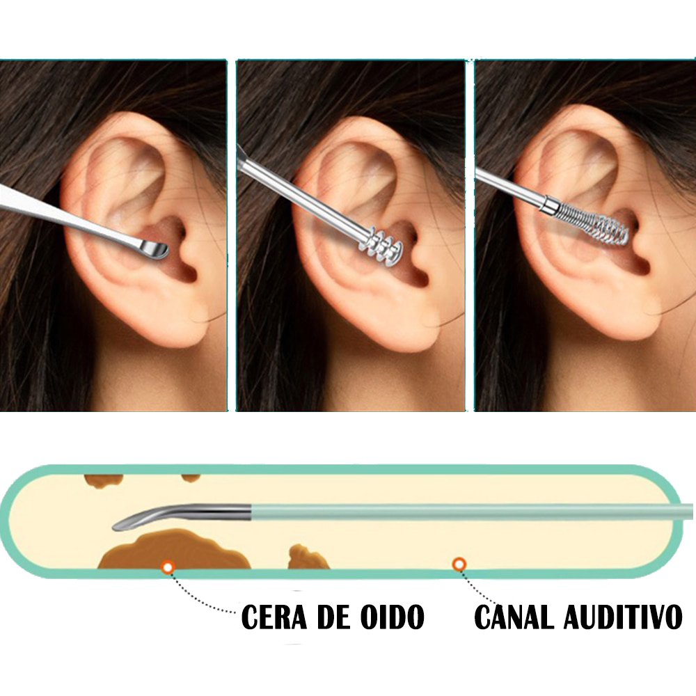  Limpiador de oídos con cámara, kit de limpieza de oídos con 6  cucharas para oídos (no 8 juegos de orejas) : Salud y Hogar